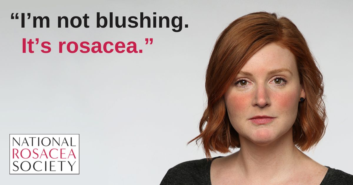 downloadable image saying i'm not blushing its rosacea