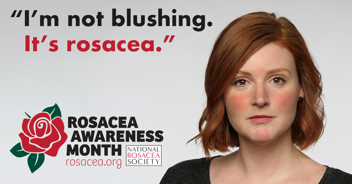 Rosacea Awareness