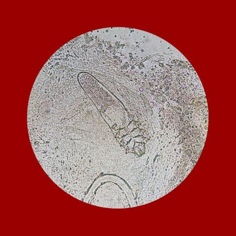 Demodex mite under microscope